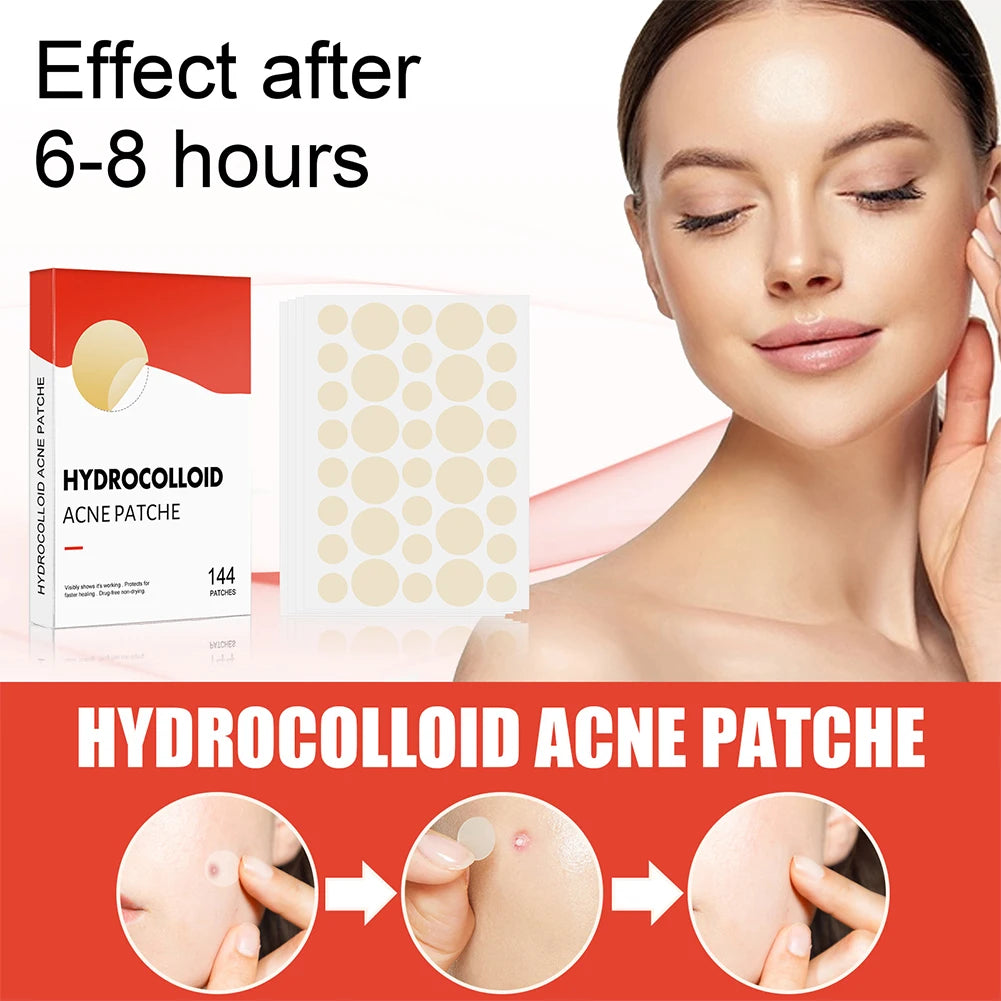 Acne Pimple Patch Skin Care