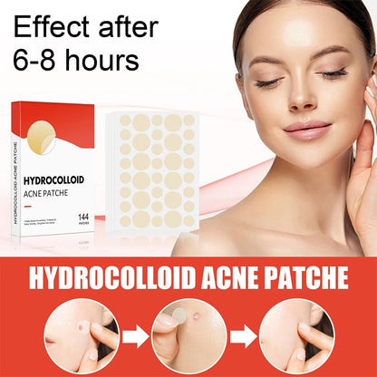 Acne Pimple Patch Skin Care