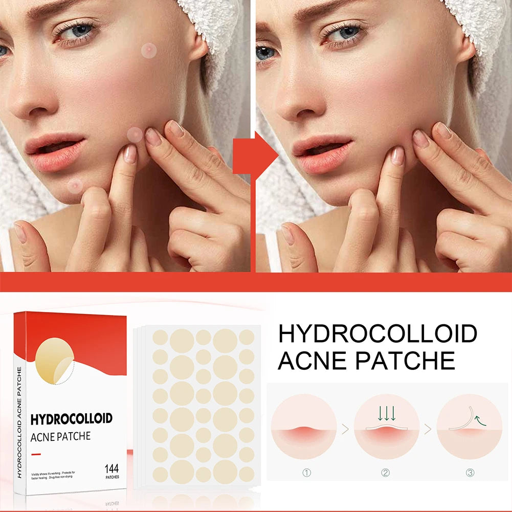 Acne Pimple Patch Skin Care