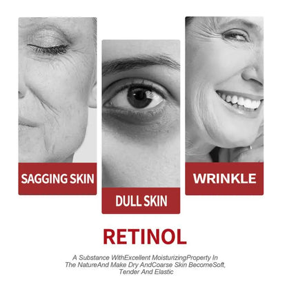 30g Retinol Wrinkle Removing Cream