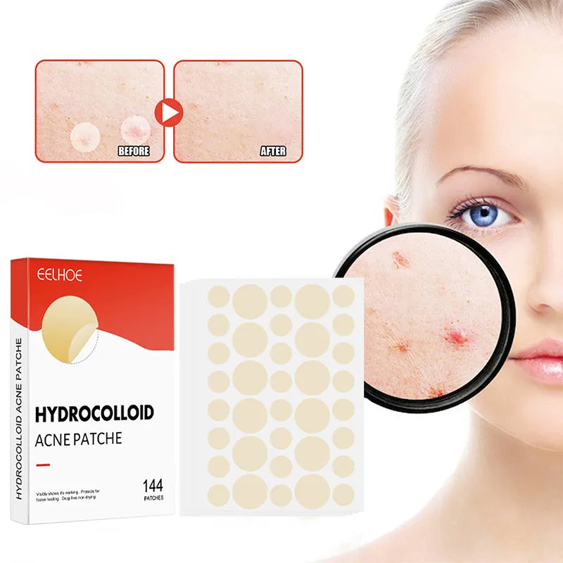 Acne Pimple Patch Skin Care