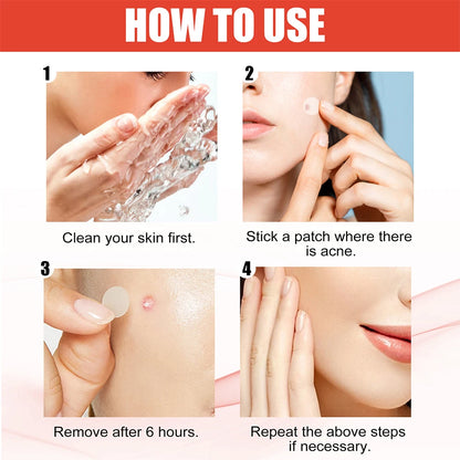 Acne Pimple Patch Skin Care